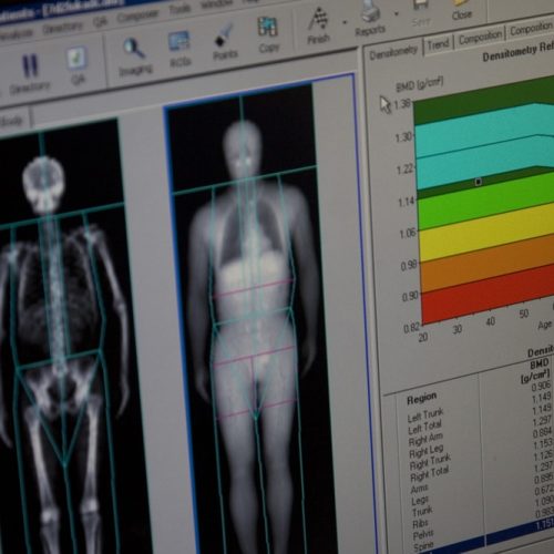 Salud ósea en la mujer: cómo fortalecer tus huesos en cada etapa de la vida 🦴✨